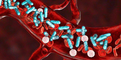 sepsis-immune-system-response-meltdown-atrain-education